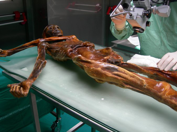 Otzi the Iceman