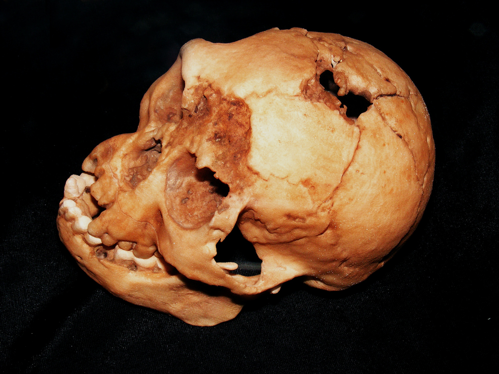 Homo floresiensis