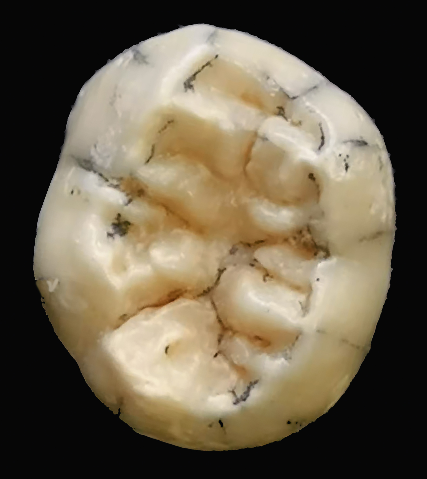 This tooth likely belonged to a young Denisovan girl who lived around 150,000 years ago