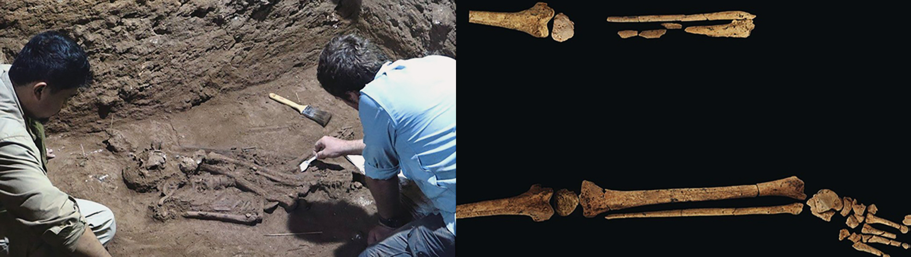 The earliest evidence ever of surgical amputation has been discovered in an Indonesian cave