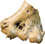 Australopithecus anamensis